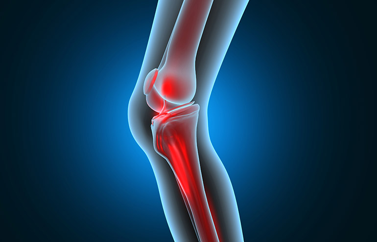 Knee replacement surgery expectations may be misaligned, says study. Source: Adobe Stock